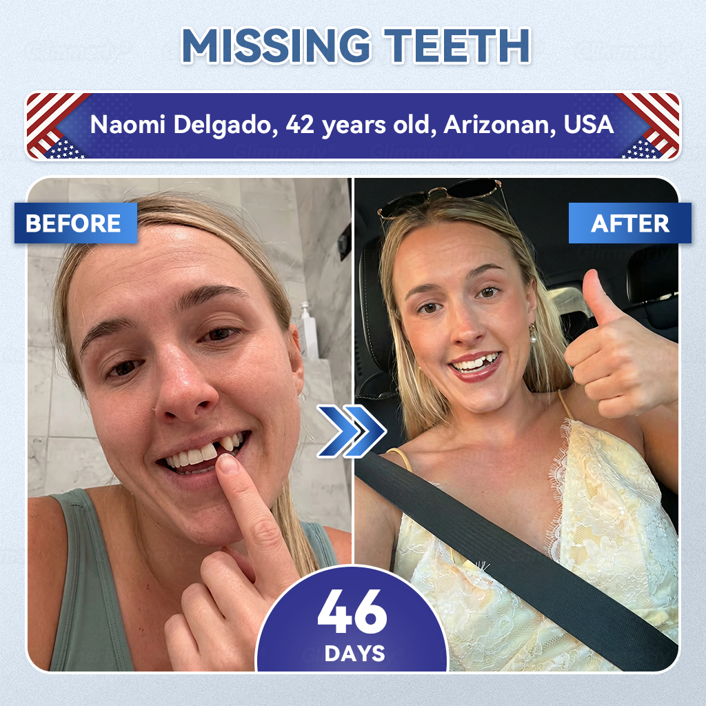 🦷𝐆𝐥𝐢𝐦𝐦𝐞𝐫𝐥𝐲® 𝐓𝐢𝐝𝐞𝐠𝐥𝐮𝐬𝐢𝐛 𝐓𝐨𝐨𝐭𝐡 & 𝐆𝐮𝐦 𝐑𝐞𝐩𝐚𝐢𝐫 𝐌𝐢𝐜𝐫𝐨𝐧𝐞𝐞𝐝𝐥𝐞 𝐏𝐚𝐭𝐜𝐡  | 𝐀𝐝𝐯𝐚𝐧𝐜𝐞𝐝 𝐒𝐭𝐞𝐦-𝐂𝐞𝐥𝐥 𝐀𝐜𝐭𝐢𝐯𝐚𝐭𝐢𝐨𝐧 𝐓𝐞𝐞𝐭𝐡 𝐒𝐭𝐫𝐢𝐩𝐬(🦷𝐑𝐞𝐛𝐮𝐢𝐥𝐝 𝐄𝐧𝐚𝐦𝐞𝐥 & 𝐃𝐞𝐧𝐭𝐢𝐧 • 𝐒𝐭𝐫𝐞𝐧𝐠𝐭𝐡𝐞𝐧 𝐆𝐮𝐦𝐬 • 𝐄𝐫𝐚𝐝𝐢𝐜𝐚𝐭𝐞 𝐓𝐚𝐫𝐭𝐚𝐫 & 𝐎𝐝𝐨𝐫 • 𝐒𝐭𝐨𝐩 𝐓𝐨𝐨𝐭𝐡 𝐒𝐞𝐧𝐬𝐢𝐭𝐢𝐯𝐢𝐭𝐲) ✈️