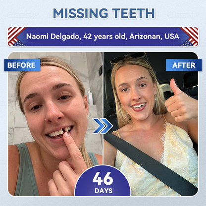🦷𝐆𝐥𝐢𝐦𝐦𝐞𝐫𝐥𝐲® 𝐓𝐢𝐝𝐞𝐠𝐥𝐮𝐬𝐢𝐛 𝐓𝐨𝐨𝐭𝐡 & 𝐆𝐮𝐦 𝐑𝐞𝐩𝐚𝐢𝐫 𝐌𝐢𝐜𝐫𝐨𝐧𝐞𝐞𝐝𝐥𝐞 𝐏𝐚𝐭𝐜𝐡  | 𝐀𝐝𝐯𝐚𝐧𝐜𝐞𝐝 𝐒𝐭𝐞𝐦-𝐂𝐞𝐥𝐥 𝐀𝐜𝐭𝐢𝐯𝐚𝐭𝐢𝐨𝐧 𝐓𝐞𝐞𝐭𝐡 𝐒𝐭𝐫𝐢𝐩𝐬(🦷𝐑𝐞𝐛𝐮𝐢𝐥𝐝 𝐄𝐧𝐚𝐦𝐞𝐥 & 𝐃𝐞𝐧𝐭𝐢𝐧 • 𝐒𝐭𝐫𝐞𝐧𝐠𝐭𝐡𝐞𝐧 𝐆𝐮𝐦𝐬 • 𝐄𝐫𝐚𝐝𝐢𝐜𝐚𝐭𝐞 𝐓𝐚𝐫𝐭𝐚𝐫 & 𝐎𝐝𝐨𝐫 • 𝐒𝐭𝐨𝐩 𝐓𝐨𝐨𝐭𝐡 𝐒𝐞𝐧𝐬𝐢𝐭𝐢𝐯𝐢𝐭𝐲) ✈️