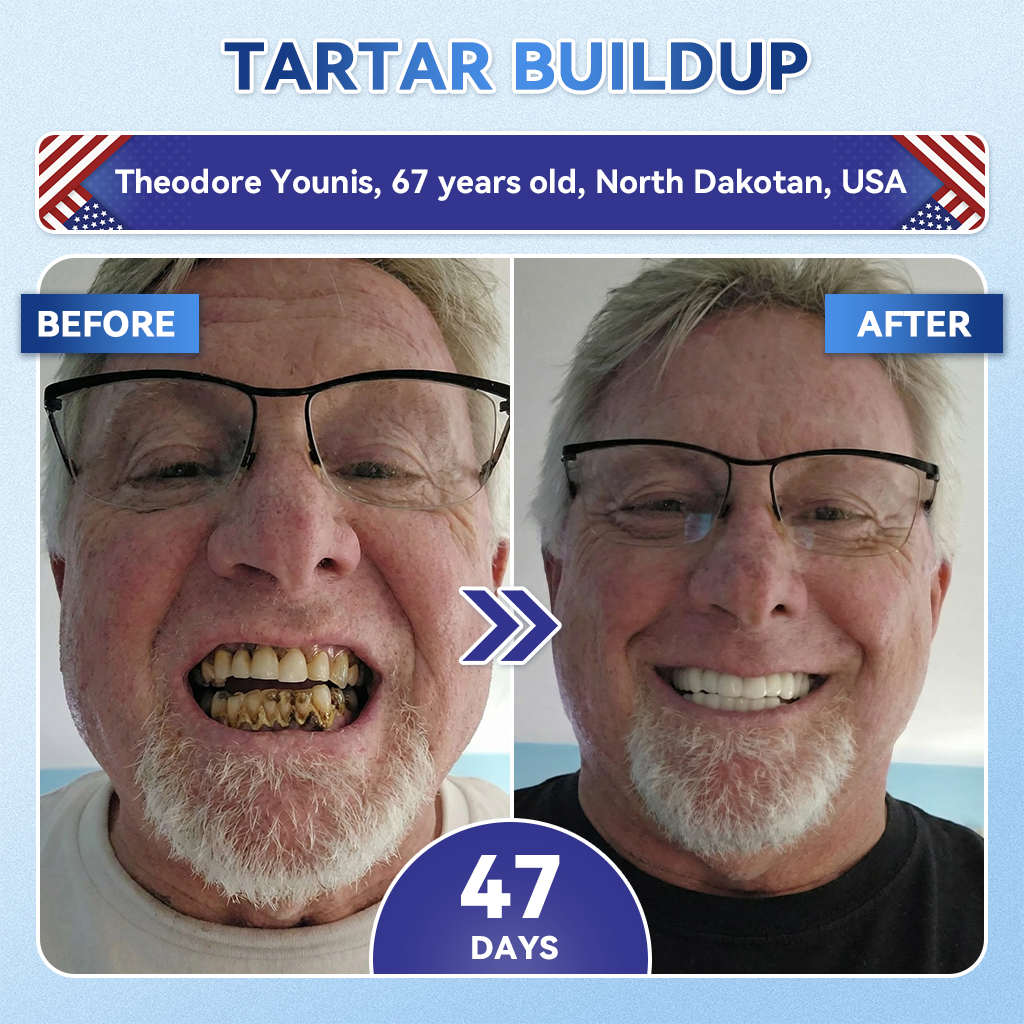 𝐆𝐥𝐢𝐦𝐦𝐞𝐫𝐥𝐲® 𝐓𝐢𝐝𝐞𝐠𝐥𝐮𝐬𝐢𝐛 𝐓𝐨𝐨𝐭𝐡 & 𝐆𝐮𝐦 𝐑𝐞𝐩𝐚𝐢𝐫 𝐌𝐢𝐜𝐫𝐨𝐧𝐞𝐞𝐝𝐥𝐞 𝐏𝐚𝐭𝐜𝐡🩹  | 𝐀𝐝𝐯𝐚𝐧𝐜𝐞𝐝 𝐒𝐭𝐞𝐦-𝐂𝐞𝐥𝐥 𝐀𝐜𝐭𝐢𝐯𝐚𝐭𝐢𝐨𝐧 𝐓𝐞𝐞𝐭𝐡 𝐒𝐭𝐫𝐢𝐩𝐬(🦷𝐑𝐞𝐛𝐮𝐢𝐥𝐝 𝐄𝐧𝐚𝐦𝐞𝐥 & 𝐃𝐞𝐧𝐭𝐢𝐧 • 𝐒𝐭𝐫𝐞𝐧𝐠𝐭𝐡𝐞𝐧 𝐆𝐮𝐦𝐬 • 𝐄𝐫𝐚𝐝𝐢𝐜𝐚𝐭𝐞 𝐓𝐚𝐫𝐭𝐚𝐫 & 𝐎𝐝𝐨𝐫 • 𝐒𝐭𝐨𝐩 𝐓𝐨𝐨𝐭𝐡 𝐒𝐞𝐧𝐬𝐢𝐭𝐢𝐯𝐢𝐭𝐲)💎