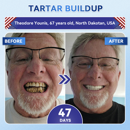 𝐆𝐥𝐢𝐦𝐦𝐞𝐫𝐥𝐲® 𝐓𝐢𝐝𝐞𝐠𝐥𝐮𝐬𝐢𝐛 𝐓𝐨𝐨𝐭𝐡 & 𝐆𝐮𝐦 𝐑𝐞𝐩𝐚𝐢𝐫 𝐌𝐢𝐜𝐫𝐨𝐧𝐞𝐞𝐝𝐥𝐞 𝐏𝐚𝐭𝐜𝐡🩹  | 𝐀𝐝𝐯𝐚𝐧𝐜𝐞𝐝 𝐒𝐭𝐞𝐦-𝐂𝐞𝐥𝐥 𝐀𝐜𝐭𝐢𝐯𝐚𝐭𝐢𝐨𝐧 𝐓𝐞𝐞𝐭𝐡 𝐒𝐭𝐫𝐢𝐩𝐬(🦷𝐑𝐞𝐛𝐮𝐢𝐥𝐝 𝐄𝐧𝐚𝐦𝐞𝐥 & 𝐃𝐞𝐧𝐭𝐢𝐧 • 𝐒𝐭𝐫𝐞𝐧𝐠𝐭𝐡𝐞𝐧 𝐆𝐮𝐦𝐬 • 𝐄𝐫𝐚𝐝𝐢𝐜𝐚𝐭𝐞 𝐓𝐚𝐫𝐭𝐚𝐫 & 𝐎𝐝𝐨𝐫 • 𝐒𝐭𝐨𝐩 𝐓𝐨𝐨𝐭𝐡 𝐒𝐞𝐧𝐬𝐢𝐭𝐢𝐯𝐢𝐭𝐲)💎