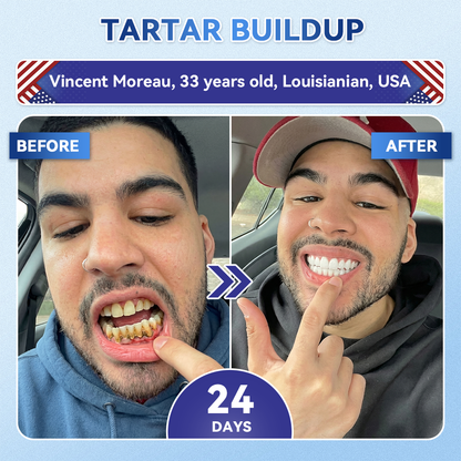 𝐆𝐥𝐢𝐦𝐦𝐞𝐫𝐥𝐲® 𝐓𝐢𝐝𝐞𝐠𝐥𝐮𝐬𝐢𝐛 𝐓𝐨𝐨𝐭𝐡 & 𝐆𝐮𝐦 𝐑𝐞𝐩𝐚𝐢𝐫 𝐌𝐢𝐜𝐫𝐨𝐧𝐞𝐞𝐝𝐥𝐞 𝐏𝐚𝐭𝐜𝐡🩹  | 𝐀𝐝𝐯𝐚𝐧𝐜𝐞𝐝 𝐒𝐭𝐞𝐦-𝐂𝐞𝐥𝐥 𝐀𝐜𝐭𝐢𝐯𝐚𝐭𝐢𝐨𝐧 𝐓𝐞𝐞𝐭𝐡 𝐒𝐭𝐫𝐢𝐩𝐬(🦷𝐑𝐞𝐛𝐮𝐢𝐥𝐝 𝐄𝐧𝐚𝐦𝐞𝐥 & 𝐃𝐞𝐧𝐭𝐢𝐧 • 𝐒𝐭𝐫𝐞𝐧𝐠𝐭𝐡𝐞𝐧 𝐆𝐮𝐦𝐬 • 𝐄𝐫𝐚𝐝𝐢𝐜𝐚𝐭𝐞 𝐓𝐚𝐫𝐭𝐚𝐫 & 𝐎𝐝𝐨𝐫 • 𝐒𝐭𝐨𝐩 𝐓𝐨𝐨𝐭𝐡 𝐒𝐞𝐧𝐬𝐢𝐭𝐢𝐯𝐢𝐭𝐲)💎