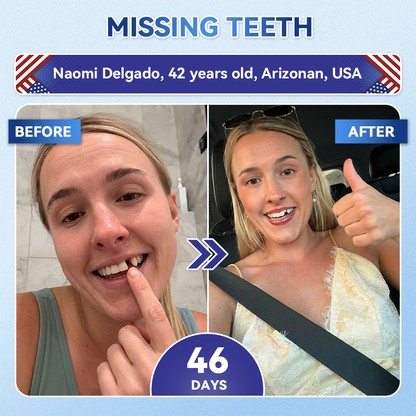 𝐆𝐥𝐢𝐦𝐦𝐞𝐫𝐥𝐲® 𝐓𝐢𝐝𝐞𝐠𝐥𝐮𝐬𝐢𝐛 𝐓𝐨𝐨𝐭𝐡 & 𝐆𝐮𝐦 𝐑𝐞𝐩𝐚𝐢𝐫 𝐌𝐢𝐜𝐫𝐨𝐧𝐞𝐞𝐝𝐥𝐞 𝐏𝐚𝐭𝐜𝐡🩹  | 𝐀𝐝𝐯𝐚𝐧𝐜𝐞𝐝 𝐒𝐭𝐞𝐦-𝐂𝐞𝐥𝐥 𝐀𝐜𝐭𝐢𝐯𝐚𝐭𝐢𝐨𝐧 𝐓𝐞𝐞𝐭𝐡 𝐒𝐭𝐫𝐢𝐩𝐬(🦷𝐑𝐞𝐛𝐮𝐢𝐥𝐝 𝐄𝐧𝐚𝐦𝐞𝐥 & 𝐃𝐞𝐧𝐭𝐢𝐧 • 𝐒𝐭𝐫𝐞𝐧𝐠𝐭𝐡𝐞𝐧 𝐆𝐮𝐦𝐬 • 𝐄𝐫𝐚𝐝𝐢𝐜𝐚𝐭𝐞 𝐓𝐚𝐫𝐭𝐚𝐫 & 𝐎𝐝𝐨𝐫 • 𝐒𝐭𝐨𝐩 𝐓𝐨𝐨𝐭𝐡 𝐒𝐞𝐧𝐬𝐢𝐭𝐢𝐯𝐢𝐭𝐲)💎