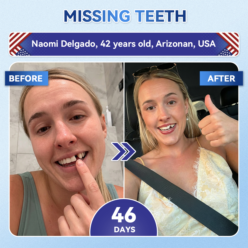 𝐆𝐥𝐢𝐦𝐦𝐞𝐫𝐥𝐲® 𝐓𝐢𝐝𝐞𝐠𝐥𝐮𝐬𝐢𝐛 𝐓𝐨𝐨𝐭𝐡 & 𝐆𝐮𝐦 𝐑𝐞𝐩𝐚𝐢𝐫 𝐌𝐢𝐜𝐫𝐨𝐧𝐞𝐞𝐝𝐥𝐞 𝐏𝐚𝐭𝐜𝐡🩹  | 𝐀𝐝𝐯𝐚𝐧𝐜𝐞𝐝 𝐒𝐭𝐞𝐦-𝐂𝐞𝐥𝐥 𝐀𝐜𝐭𝐢𝐯𝐚𝐭𝐢𝐨𝐧 𝐓𝐞𝐞𝐭𝐡 𝐒𝐭𝐫𝐢𝐩𝐬(🦷𝐑𝐞𝐛𝐮𝐢𝐥𝐝 𝐄𝐧𝐚𝐦𝐞𝐥 & 𝐃𝐞𝐧𝐭𝐢𝐧 • 𝐒𝐭𝐫𝐞𝐧𝐠𝐭𝐡𝐞𝐧 𝐆𝐮𝐦𝐬 • 𝐄𝐫𝐚𝐝𝐢𝐜𝐚𝐭𝐞 𝐓𝐚𝐫𝐭𝐚𝐫 & 𝐎𝐝𝐨𝐫 • 𝐒𝐭𝐨𝐩 𝐓𝐨𝐨𝐭𝐡 𝐒𝐞𝐧𝐬𝐢𝐭𝐢𝐯𝐢𝐭𝐲)🦷