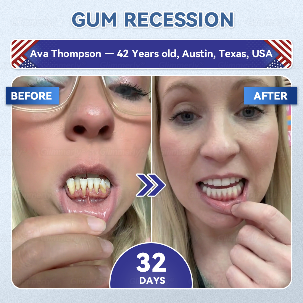 🦷𝐆𝐥𝐢𝐦𝐦𝐞𝐫𝐥𝐲® 𝐓𝐢𝐝𝐞𝐠𝐥𝐮𝐬𝐢𝐛 𝐓𝐨𝐨𝐭𝐡 & 𝐆𝐮𝐦 𝐑𝐞𝐩𝐚𝐢𝐫 𝐌𝐢𝐜𝐫𝐨𝐧𝐞𝐞𝐝𝐥𝐞 𝐏𝐚𝐭𝐜𝐡  | 𝐀𝐝𝐯𝐚𝐧𝐜𝐞𝐝 𝐒𝐭𝐞𝐦-𝐂𝐞𝐥𝐥 𝐀𝐜𝐭𝐢𝐯𝐚𝐭𝐢𝐨𝐧 𝐓𝐞𝐞𝐭𝐡 𝐒𝐭𝐫𝐢𝐩𝐬(🦷𝐑𝐞𝐛𝐮𝐢𝐥𝐝 𝐄𝐧𝐚𝐦𝐞𝐥 & 𝐃𝐞𝐧𝐭𝐢𝐧 • 𝐒𝐭𝐫𝐞𝐧𝐠𝐭𝐡𝐞𝐧 𝐆𝐮𝐦𝐬 • 𝐄𝐫𝐚𝐝𝐢𝐜𝐚𝐭𝐞 𝐓𝐚𝐫𝐭𝐚𝐫 & 𝐎𝐝𝐨𝐫 • 𝐒𝐭𝐨𝐩 𝐓𝐨𝐨𝐭𝐡 𝐒𝐞𝐧𝐬𝐢𝐭𝐢𝐯𝐢𝐭𝐲) ✈️