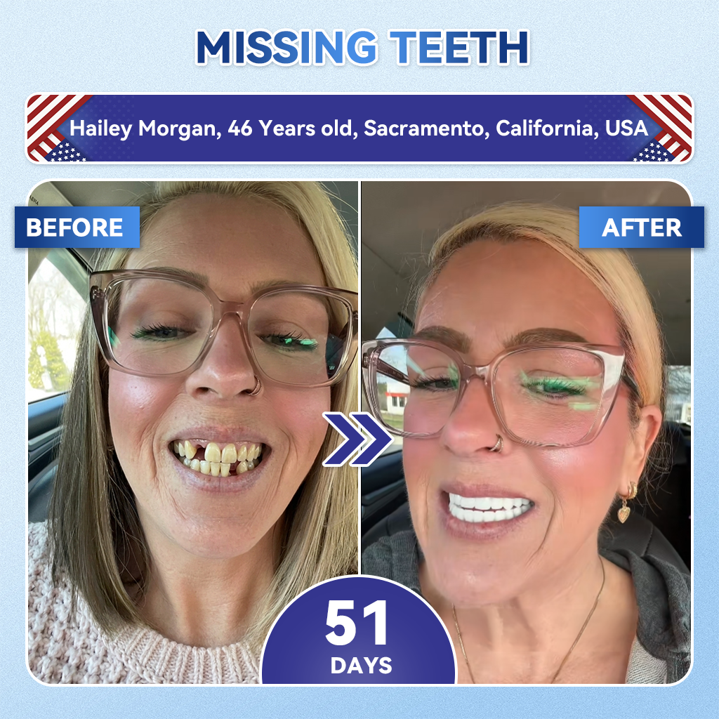 𝐆𝐥𝐢𝐦𝐦𝐞𝐫𝐥𝐲® 𝐓𝐢𝐝𝐞𝐠𝐥𝐮𝐬𝐢𝐛 𝐓𝐨𝐨𝐭𝐡 & 𝐆𝐮𝐦 𝐑𝐞𝐩𝐚𝐢𝐫 𝐌𝐢𝐜𝐫𝐨𝐧𝐞𝐞𝐝𝐥𝐞 𝐏𝐚𝐭𝐜𝐡🩹  | 𝐀𝐝𝐯𝐚𝐧𝐜𝐞𝐝 𝐒𝐭𝐞𝐦-𝐂𝐞𝐥𝐥 𝐀𝐜𝐭𝐢𝐯𝐚𝐭𝐢𝐨𝐧 𝐓𝐞𝐞𝐭𝐡 𝐒𝐭𝐫𝐢𝐩𝐬(🦷𝐑𝐞𝐛𝐮𝐢𝐥𝐝 𝐄𝐧𝐚𝐦𝐞𝐥 & 𝐃𝐞𝐧𝐭𝐢𝐧 • 𝐒𝐭𝐫𝐞𝐧𝐠𝐭𝐡𝐞𝐧 𝐆𝐮𝐦𝐬 • 𝐄𝐫𝐚𝐝𝐢𝐜𝐚𝐭𝐞 𝐓𝐚𝐫𝐭𝐚𝐫 & 𝐎𝐝𝐨𝐫 • 𝐒𝐭𝐨𝐩 𝐓𝐨𝐨𝐭𝐡 𝐒𝐞𝐧𝐬𝐢𝐭𝐢𝐯𝐢𝐭𝐲)🦷