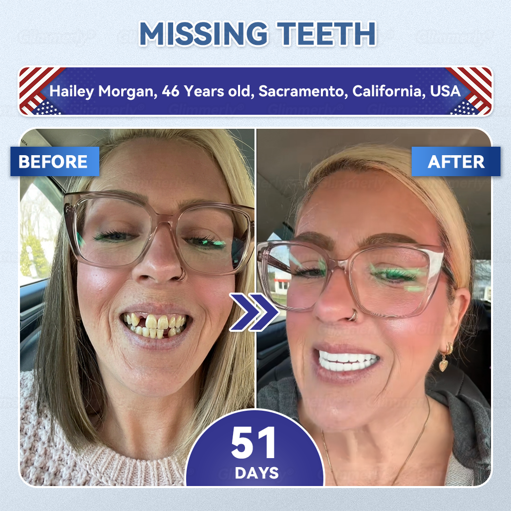 🦷𝐆𝐥𝐢𝐦𝐦𝐞𝐫𝐥𝐲® 𝐓𝐢𝐝𝐞𝐠𝐥𝐮𝐬𝐢𝐛 𝐓𝐨𝐨𝐭𝐡 & 𝐆𝐮𝐦 𝐑𝐞𝐩𝐚𝐢𝐫 𝐌𝐢𝐜𝐫𝐨𝐧𝐞𝐞𝐝𝐥𝐞 𝐏𝐚𝐭𝐜𝐡  | 𝐀𝐝𝐯𝐚𝐧𝐜𝐞𝐝 𝐒𝐭𝐞𝐦-𝐂𝐞𝐥𝐥 𝐀𝐜𝐭𝐢𝐯𝐚𝐭𝐢𝐨𝐧 𝐓𝐞𝐞𝐭𝐡 𝐒𝐭𝐫𝐢𝐩𝐬(🦷𝐑𝐞𝐛𝐮𝐢𝐥𝐝 𝐄𝐧𝐚𝐦𝐞𝐥 & 𝐃𝐞𝐧𝐭𝐢𝐧 • 𝐒𝐭𝐫𝐞𝐧𝐠𝐭𝐡𝐞𝐧 𝐆𝐮𝐦𝐬 • 𝐄𝐫𝐚𝐝𝐢𝐜𝐚𝐭𝐞 𝐓𝐚𝐫𝐭𝐚𝐫 & 𝐎𝐝𝐨𝐫 • 𝐒𝐭𝐨𝐩 𝐓𝐨𝐨𝐭𝐡 𝐒𝐞𝐧𝐬𝐢𝐭𝐢𝐯𝐢𝐭𝐲) ✈️