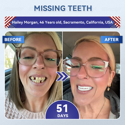 🦷𝐆𝐥𝐢𝐦𝐦𝐞𝐫𝐥𝐲® 𝐓𝐢𝐝𝐞𝐠𝐥𝐮𝐬𝐢𝐛 𝐓𝐨𝐨𝐭𝐡 & 𝐆𝐮𝐦 𝐑𝐞𝐩𝐚𝐢𝐫 𝐌𝐢𝐜𝐫𝐨𝐧𝐞𝐞𝐝𝐥𝐞 𝐏𝐚𝐭𝐜𝐡  | 𝐀𝐝𝐯𝐚𝐧𝐜𝐞𝐝 𝐒𝐭𝐞𝐦-𝐂𝐞𝐥𝐥 𝐀𝐜𝐭𝐢𝐯𝐚𝐭𝐢𝐨𝐧 𝐓𝐞𝐞𝐭𝐡 𝐒𝐭𝐫𝐢𝐩𝐬(🦷𝐑𝐞𝐛𝐮𝐢𝐥𝐝 𝐄𝐧𝐚𝐦𝐞𝐥 & 𝐃𝐞𝐧𝐭𝐢𝐧 • 𝐒𝐭𝐫𝐞𝐧𝐠𝐭𝐡𝐞𝐧 𝐆𝐮𝐦𝐬 • 𝐄𝐫𝐚𝐝𝐢𝐜𝐚𝐭𝐞 𝐓𝐚𝐫𝐭𝐚𝐫 & 𝐎𝐝𝐨𝐫 • 𝐒𝐭𝐨𝐩 𝐓𝐨𝐨𝐭𝐡 𝐒𝐞𝐧𝐬𝐢𝐭𝐢𝐯𝐢𝐭𝐲) ✈️