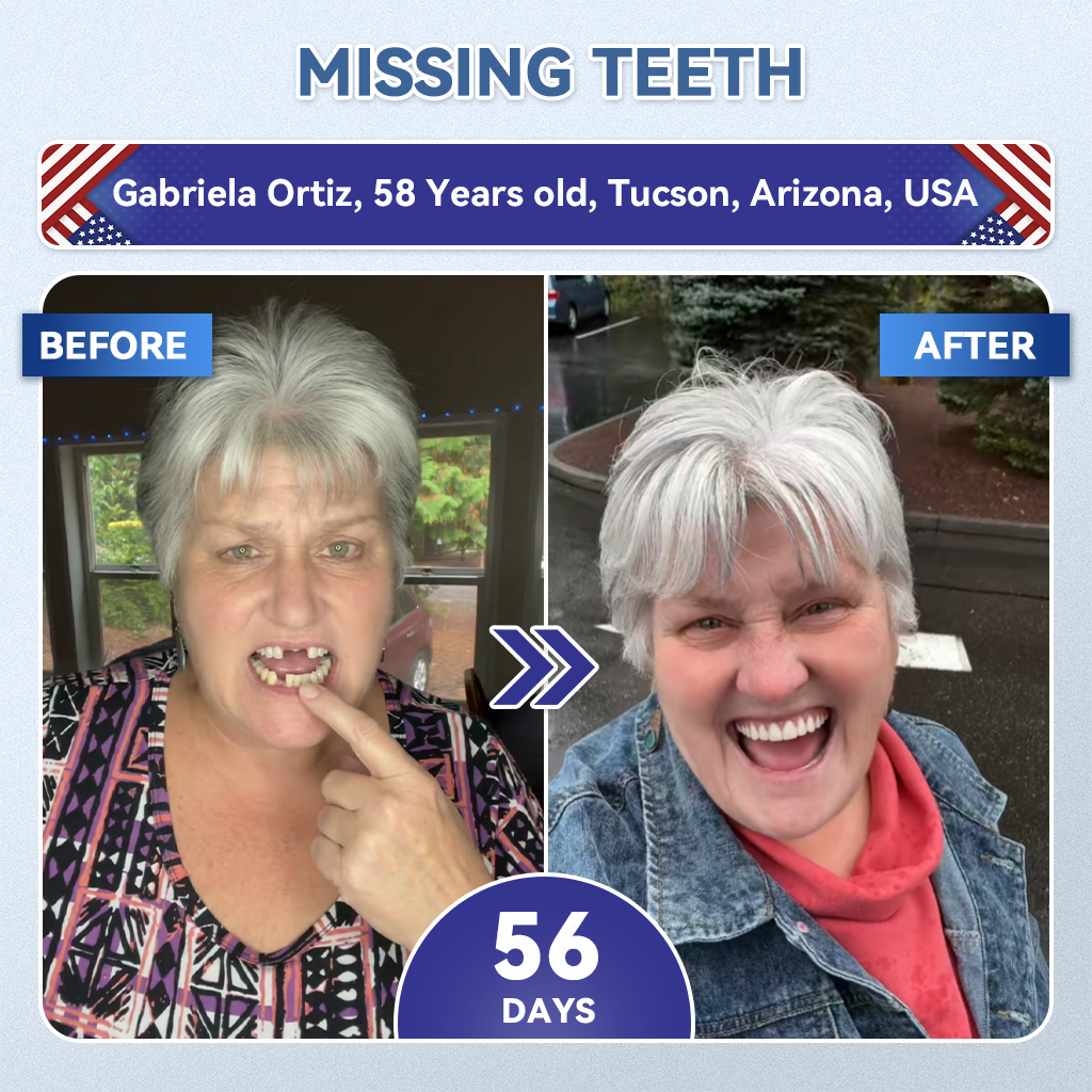 🦷𝐆𝐥𝐢𝐦𝐦𝐞𝐫𝐥𝐲® 𝐓𝐢𝐝𝐞𝐠𝐥𝐮𝐬𝐢𝐛 𝐓𝐨𝐨𝐭𝐡 & 𝐆𝐮𝐦 𝐑𝐞𝐩𝐚𝐢𝐫 𝐌𝐢𝐜𝐫𝐨𝐧𝐞𝐞𝐝𝐥𝐞 𝐏𝐚𝐭𝐜𝐡  | 𝐀𝐝𝐯𝐚𝐧𝐜𝐞𝐝 𝐒𝐭𝐞𝐦-𝐂𝐞𝐥𝐥 𝐀𝐜𝐭𝐢𝐯𝐚𝐭𝐢𝐨𝐧 𝐓𝐞𝐞𝐭𝐡 𝐒𝐭𝐫𝐢𝐩𝐬(🦷𝐑𝐞𝐛𝐮𝐢𝐥𝐝 𝐄𝐧𝐚𝐦𝐞𝐥 & 𝐃𝐞𝐧𝐭𝐢𝐧 • 𝐒𝐭𝐫𝐞𝐧𝐠𝐭𝐡𝐞𝐧 𝐆𝐮𝐦𝐬 • 𝐄𝐫𝐚𝐝𝐢𝐜𝐚𝐭𝐞 𝐓𝐚𝐫𝐭𝐚𝐫 & 𝐎𝐝𝐨𝐫 • 𝐒𝐭𝐨𝐩 𝐓𝐨𝐨𝐭𝐡 𝐒𝐞𝐧𝐬𝐢𝐭𝐢𝐯𝐢𝐭𝐲) ✈️