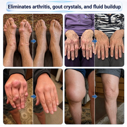 𝗜𝗙𝑴𝑨𝑮𝑰𝑪® 🦴𝗠𝗶𝗰𝗿𝗼𝒏𝒆𝒆𝒅𝒍𝒆 𝗝𝗼𝗶𝗻𝘁 𝑹𝒆𝒍𝒊𝒆𝒇 𝑹𝒐𝒍𝒍-𝗢𝗻💪
