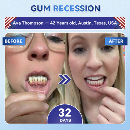𝐆𝐥𝐢𝐦𝐦𝐞𝐫𝐥𝐲® 𝐓𝐢𝐝𝐞𝐠𝐥𝐮𝐬𝐢𝐛 𝐓𝐨𝐨𝐭𝐡 & 𝐆𝐮𝐦 𝐑𝐞𝐩𝐚𝐢𝐫 𝐌𝐢𝐜𝐫𝐨𝐧𝐞𝐞𝐝𝐥𝐞 𝐏𝐚𝐭𝐜𝐡🩹  | 𝐀𝐝𝐯𝐚𝐧𝐜𝐞𝐝 𝐒𝐭𝐞𝐦-𝐂𝐞𝐥𝐥 𝐀𝐜𝐭𝐢𝐯𝐚𝐭𝐢𝐨𝐧 𝐓𝐞𝐞𝐭𝐡 𝐒𝐭𝐫𝐢𝐩𝐬(🦷𝐑𝐞𝐛𝐮𝐢𝐥𝐝 𝐄𝐧𝐚𝐦𝐞𝐥 & 𝐃𝐞𝐧𝐭𝐢𝐧 • 𝐒𝐭𝐫𝐞𝐧𝐠𝐭𝐡𝐞𝐧 𝐆𝐮𝐦𝐬 • 𝐄𝐫𝐚𝐝𝐢𝐜𝐚𝐭𝐞 𝐓𝐚𝐫𝐭𝐚𝐫 & 𝐎𝐝𝐨𝐫 • 𝐒𝐭𝐨𝐩 𝐓𝐨𝐨𝐭𝐡 𝐒𝐞𝐧𝐬𝐢𝐭𝐢𝐯𝐢𝐭𝐲)🦷