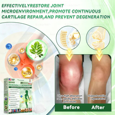 Official Store | 🩹 𝑳𝒖𝒙𝒂𝑟𝑖𝑠𝑒® Moringa & Berberine 10-IN-1 Advanced Nano Microneedle Patch ✅ Once a Day. See Visible Results in Just 7 Days.